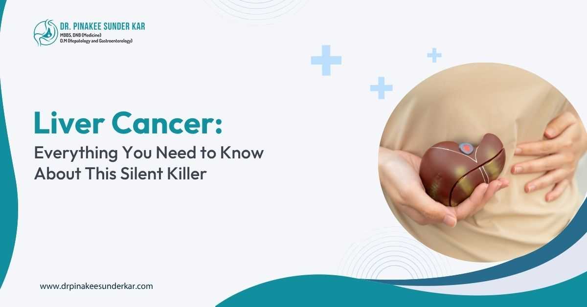 Liver Cancer- Everything You Need to Know About This Silent Killer