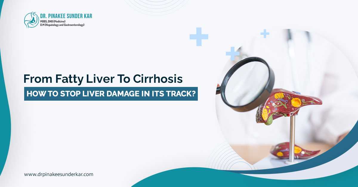 Fatty liver treatment in Siliguri