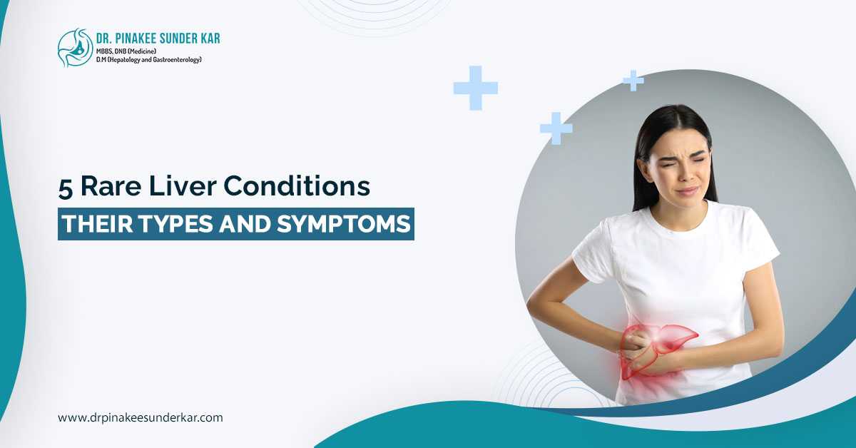 liver specialist in North Bengal