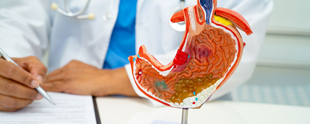 Inflammatory Bowel Disease