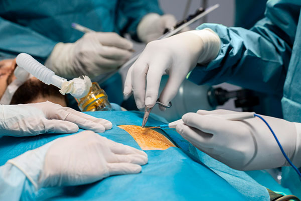 Liver Transplant Surgery in Siliguri